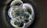 Geklonter menschlicher Embryo (© picture-alliance/dpa)