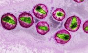 Клетки ВИЧ под микроскопом. (© picture-alliance/dpa)