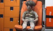 Five-year-old Omran Daqneesh. (© picture-alliance/dpa)